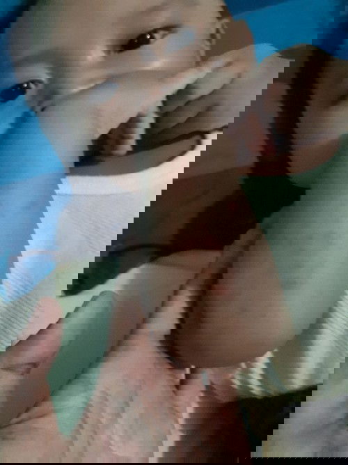 Tangan merah2 di kasih apa sebaiknya