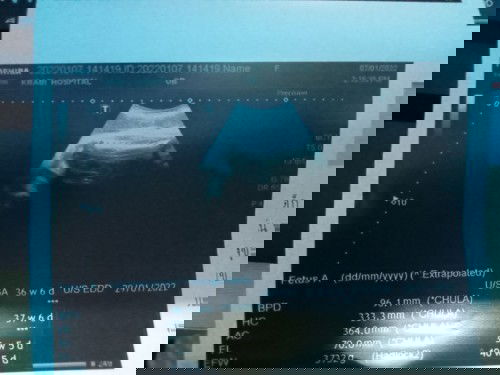 แม่ๆค่ะ พอจะดูออกไม่ค่ะ ว่าน้องเป็นผู้หญิงหรือผู้ชาย