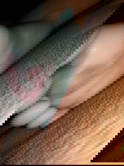 Swollen fit and red rashes