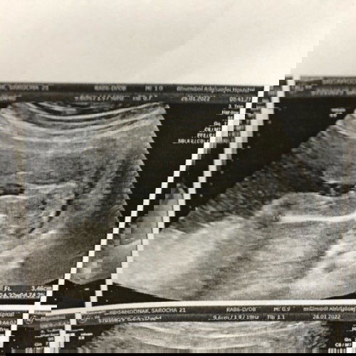 ท้องได้ 25 week แล้วค่ะ