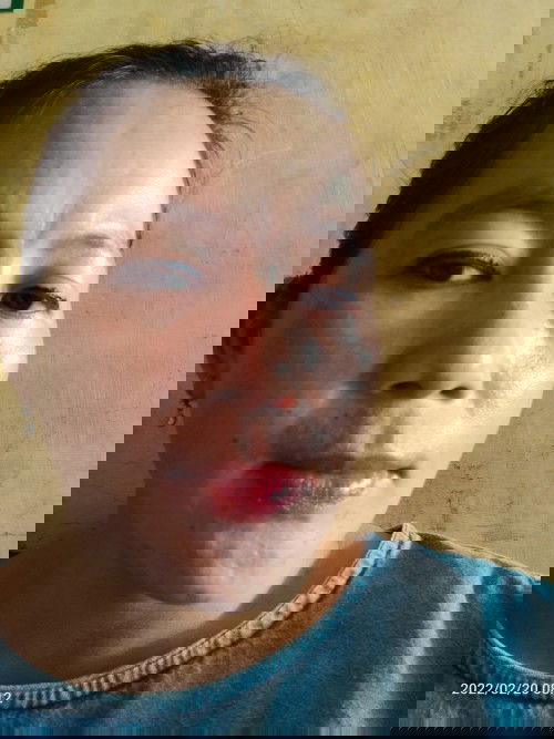 Cara menghilangkan flek hitam di wajah