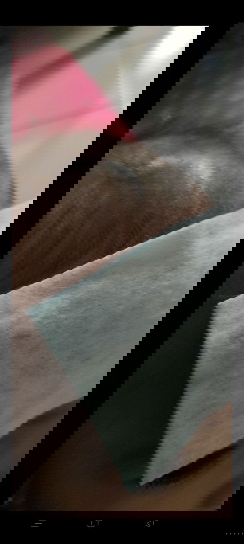 bayi 6bln demam, ada benjolan diubun2