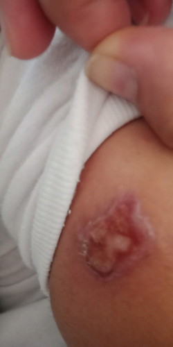 hello po mga mamsh
ask ko lang po baka alam nyo anu mgandang anti baxterial na sabon for 2years old