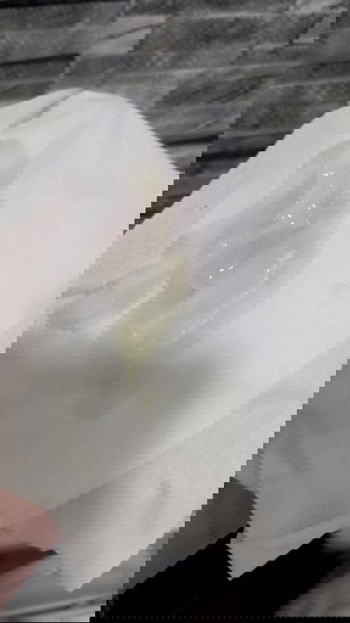 สอบถามแม่ท้องค่ะ แบบนี้เรียกตกขาวใช่ไหมคะ อันตรายไหมคะ