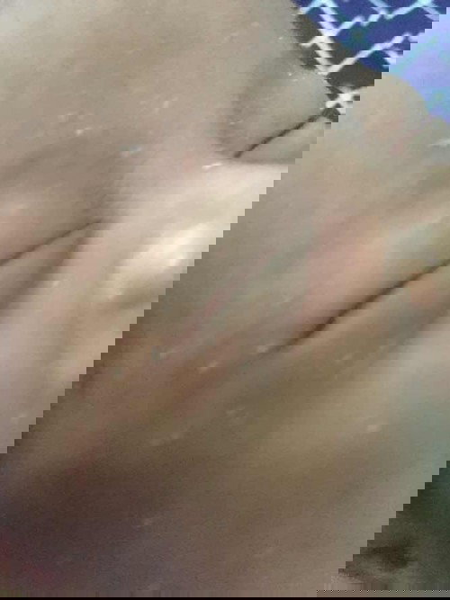 Bintik putih pada bayi