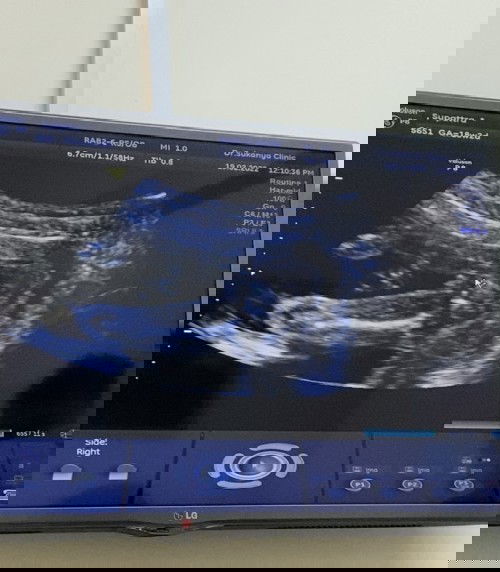 สวัสดีค่ะ #ท้องแรกค่ะ