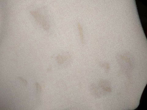 ไม่แน่ใจว่าเป็นหมาดขาวหรือว่าน้ำอะไรไหลออกมาไม่เยอะ กลางคืนก็ไหลออกจับดูเป็นน้ำพอแห้งจะเป็นสีเหลือๆ