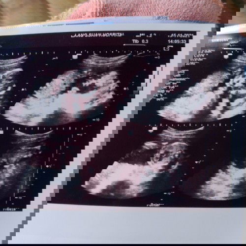 คำถาม คำตอบ