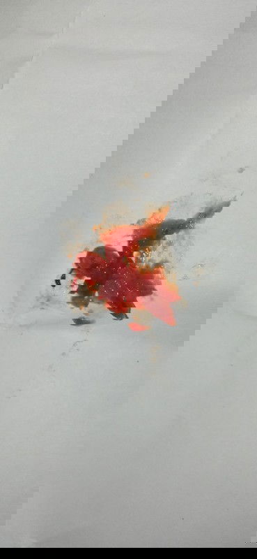 Keguguran atau bukan?