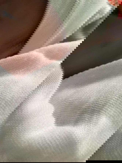 Các mom có ai có con bị vậy không ạ. Ai biết là bị sao k a