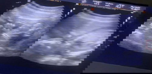 แม่ว่าเพศอะไรคะ