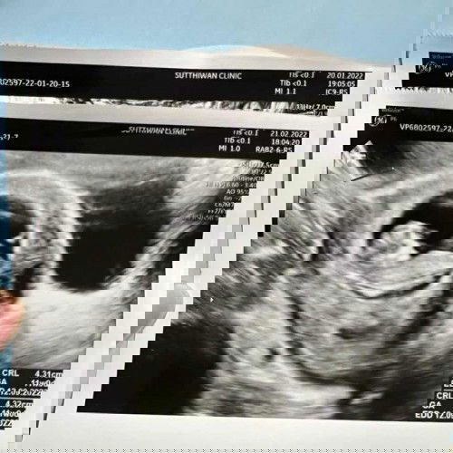 #ทีมกันยา65 #ลูกคนแรก