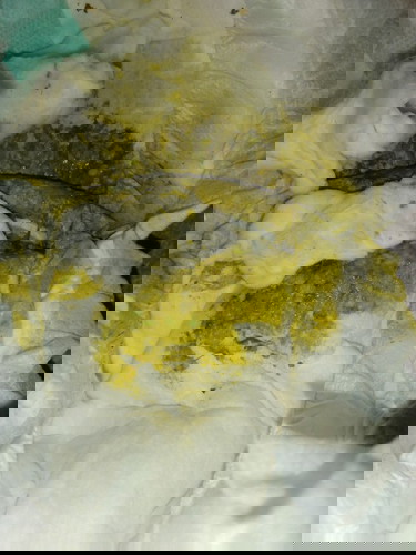 อึน้องเป็นสีนี้ ปกติไหมคะ