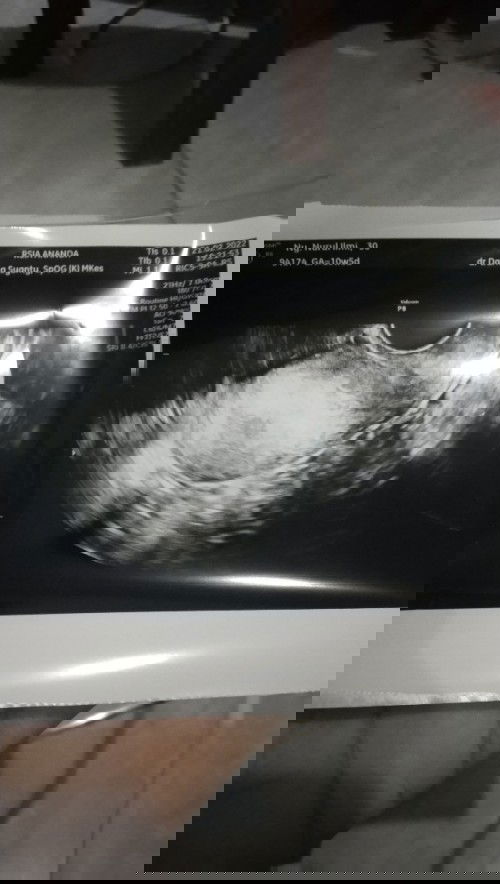 janin belum terlihat