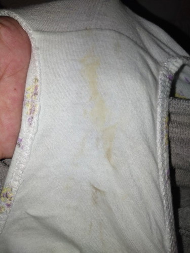 36 weeks pregnant discharge