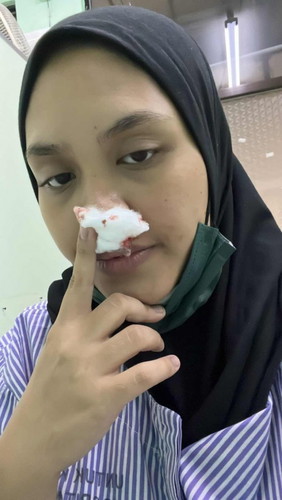 HIDUNG BERDARAH 37 minggu mengandung