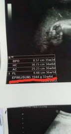 ขอสอบถามแม่ๆหน่อยคะ