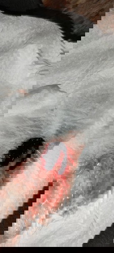 7weeks pregnant - blood