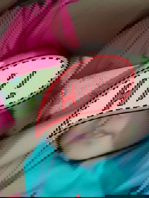 Bibir bayi bagian bawah hitam tiba tiba