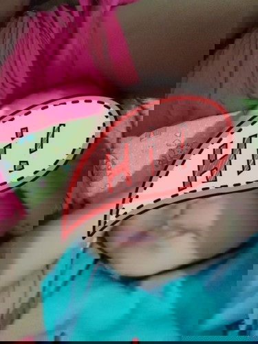 Bibir bayi bagian bawah hitam tiba tiba