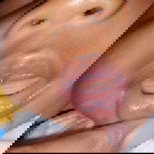 Teething at 7weeks old