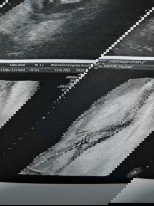 คุณหมอบอกน้องจมูกใหญ่??