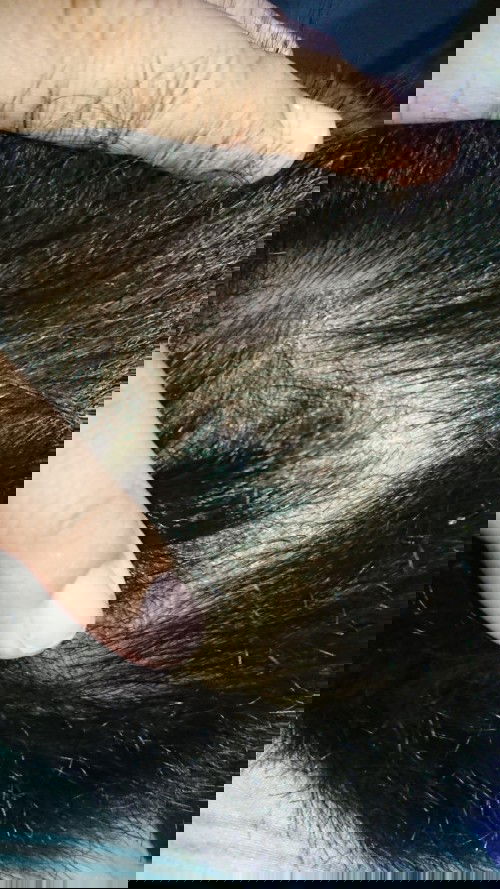 Kepala bayi berkerak