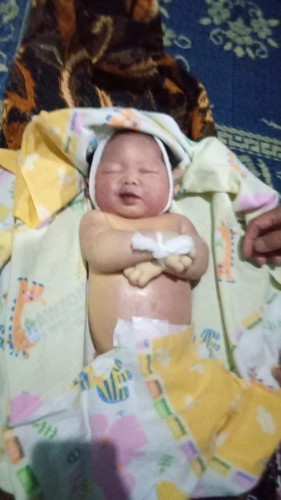 Lahir usia 35minggu lebih 2 hari