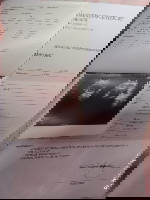 Good Day Mga Momsh,Ask lang po.