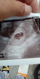 แม่มีใหม่ยังไม่รุ้อ่ะไรเกี่ยวกับลูกช่วยนะนำหน่อยนะค่ะต้องทานอะไรบ้างเพื่อบำรุงเพื่อลูกของเราบอกด้วยค