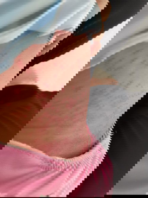 Nama penyakit nya apa