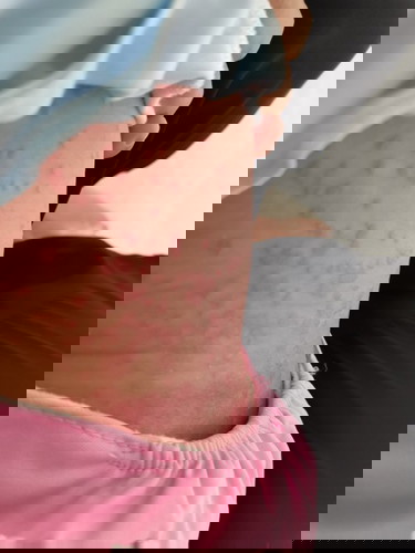 Nama penyakit nya apa