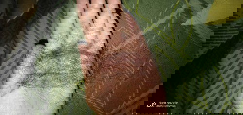 Saat menyusui rambut rontok parah