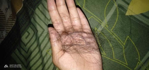 Saat menyusui rambut rontok parah