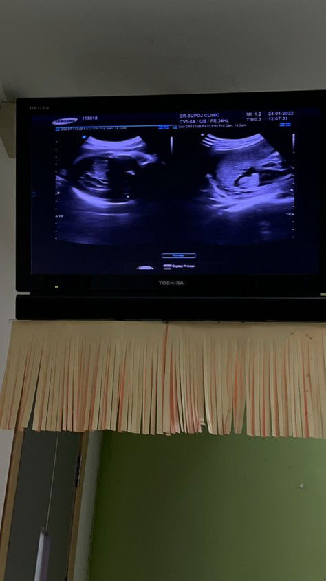 ดูเพศเพื่อความชัวร์หน่อยค่ะแม่☺️