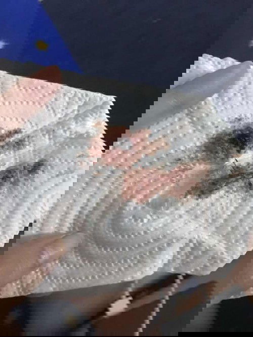 กระตุ้นปากมดลูก 38+5