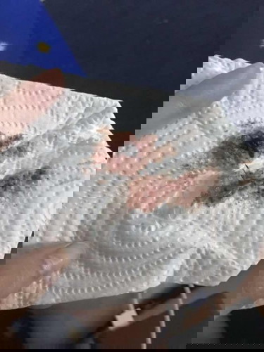 กระตุ้นปากมดลูก 38+5