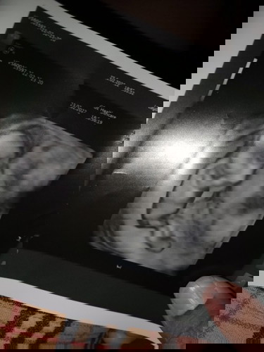 ทีมท้องสอง