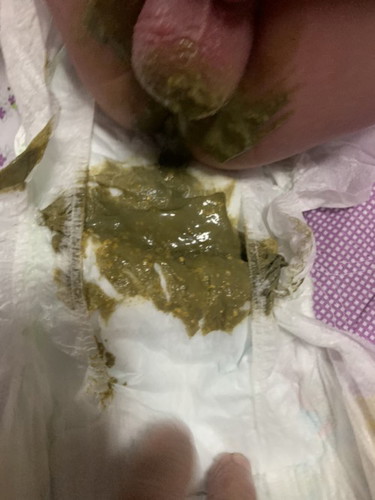 Berak bayi