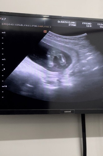 ทีมสิงหา ท้องสอง ลูกสาวค่ะ 😅😅