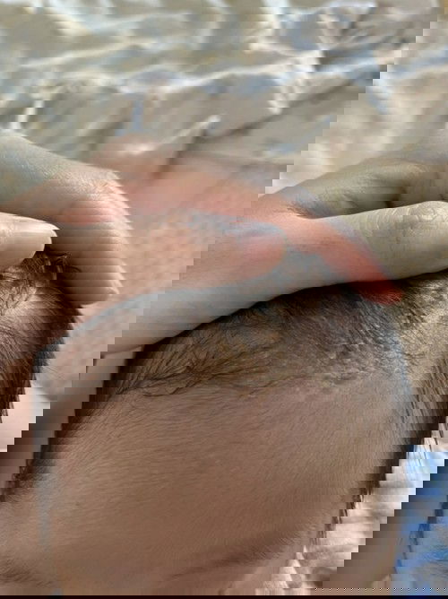 เด็กๆบ้านไหนเป็นบ้าง ขอคำแนะนำหน่อยค่ะ