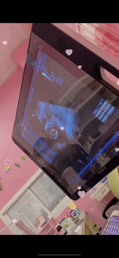 ท้องสอง👧🏻👶🏻ลุ้นอีกทีตอน8เดือน🥰