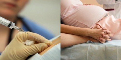 Ibu, adakah anda tahu tentang Epidural?