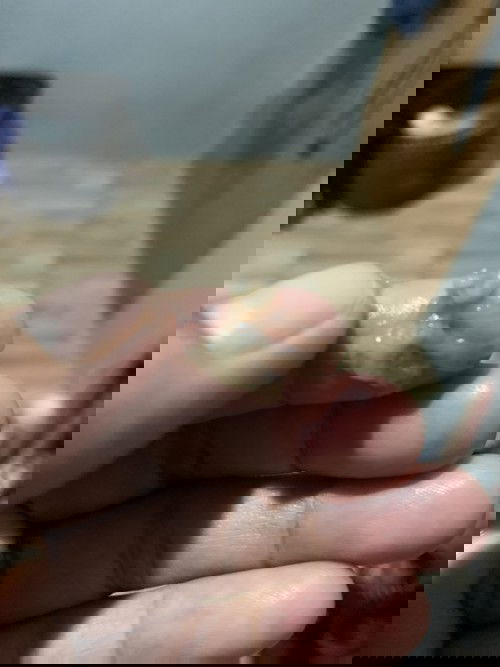 Is this Mucus Plug??