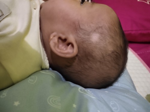 Rontok rambut bayi