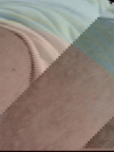 Gatal gatal pasca melahirkan normal