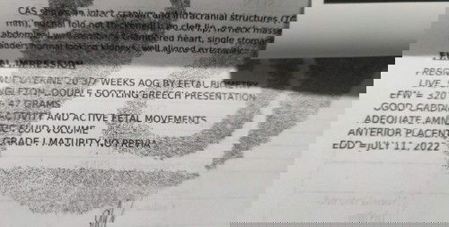 ILANG WEEKS KAYO MOMMY NAG PA CAS?