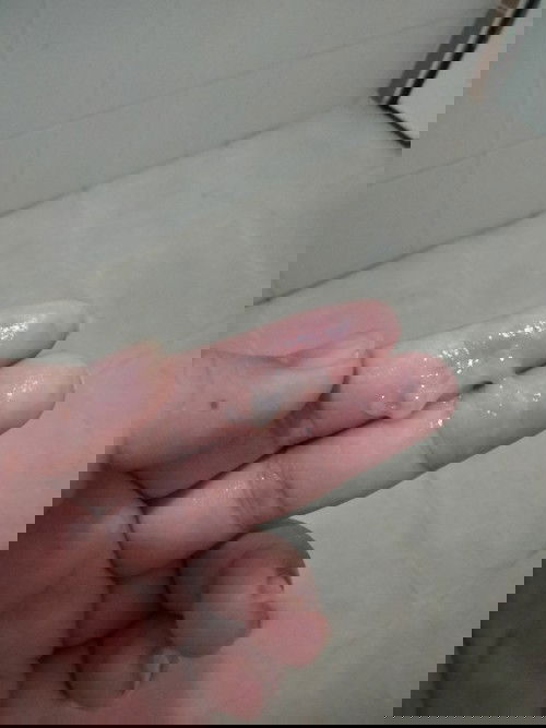 สอบถามแม่ๆๆค่ะว่าแบบนี้ตกขาวหรือมูก