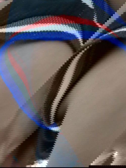 ผื่นแพ้แบบนี้คืออะไร