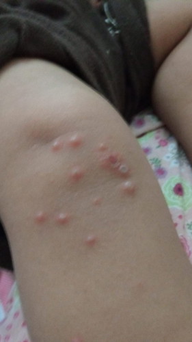 (Sudah terjawab). Darurat. Tolong bantuannya ya, moms.